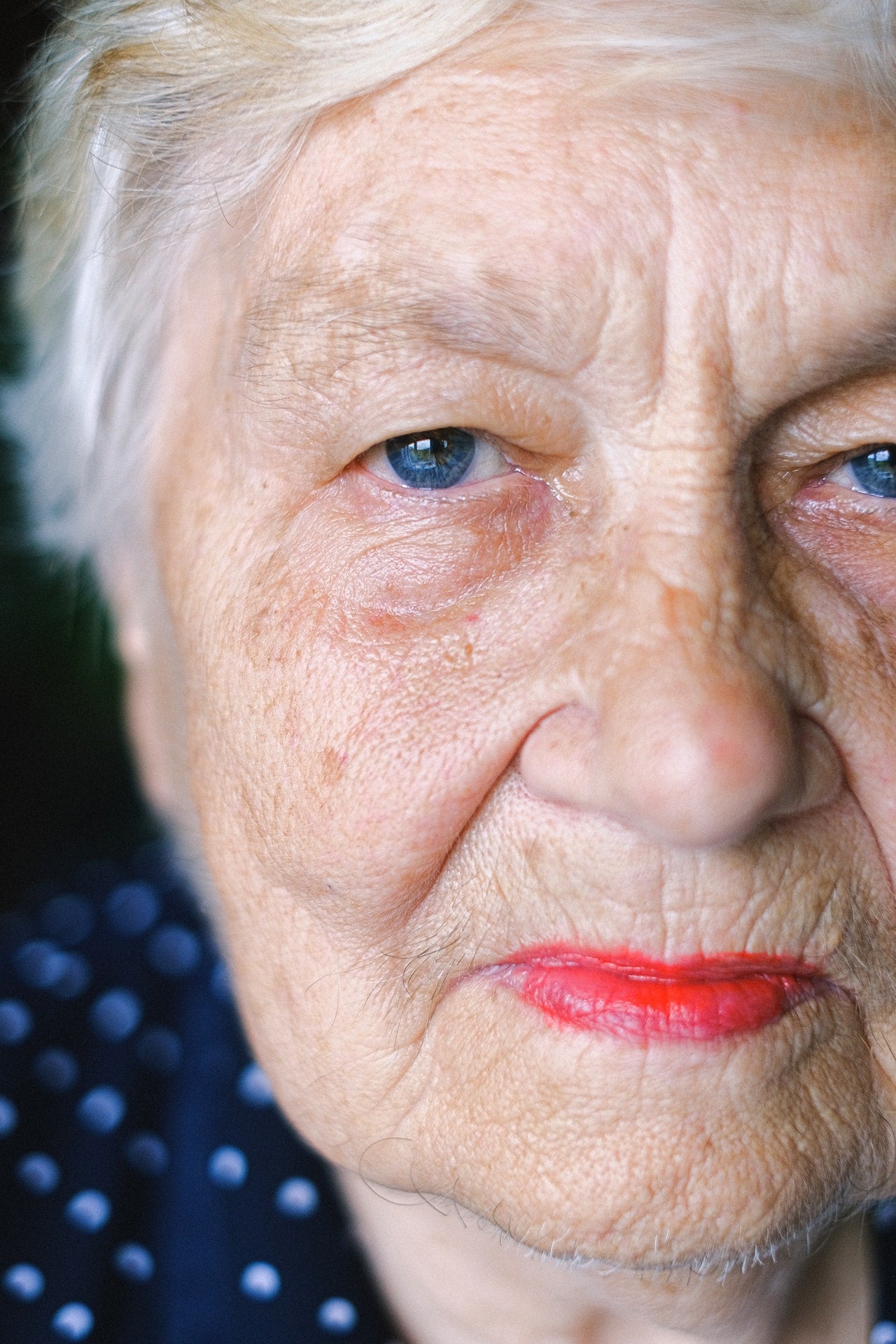 The Best Vitamin for Dark Spots - Beautystat